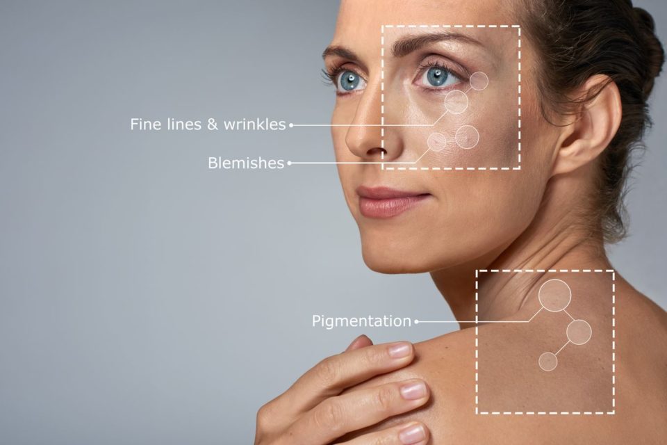 Sykesville Eldersburg Chemical Peels
