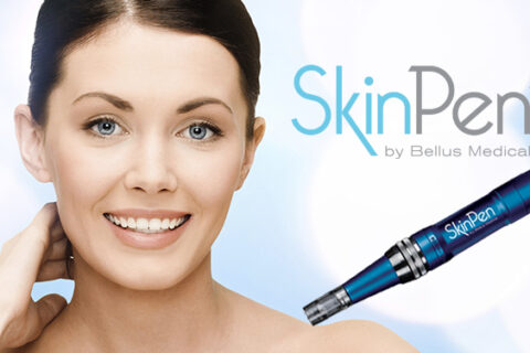 PRP Facial Microneedling