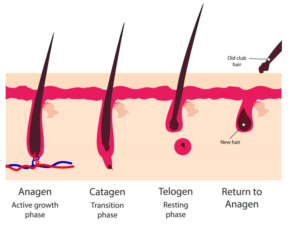 Hair restoration Eldersburg MD