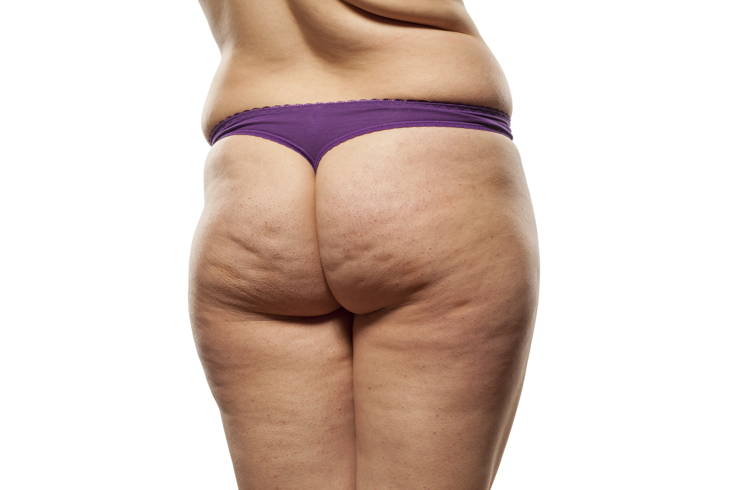 Maryland Cellulite Center